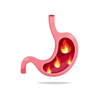 GERD / Acidity